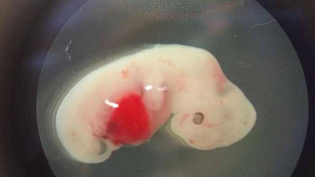 Hybrid sheep-human embryos – transplant hopes and ethics