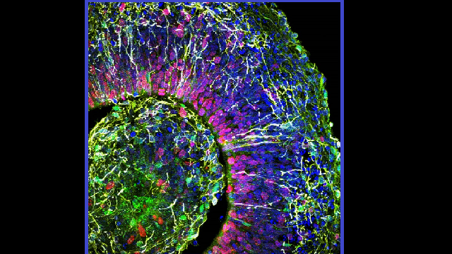 Brainwaves detected in mini-brains grown in a dish