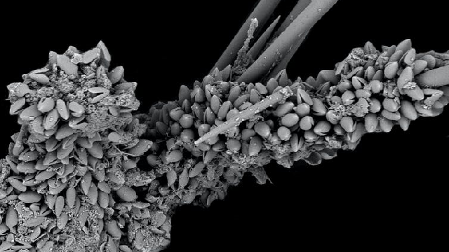 Sea sponge under a microscope